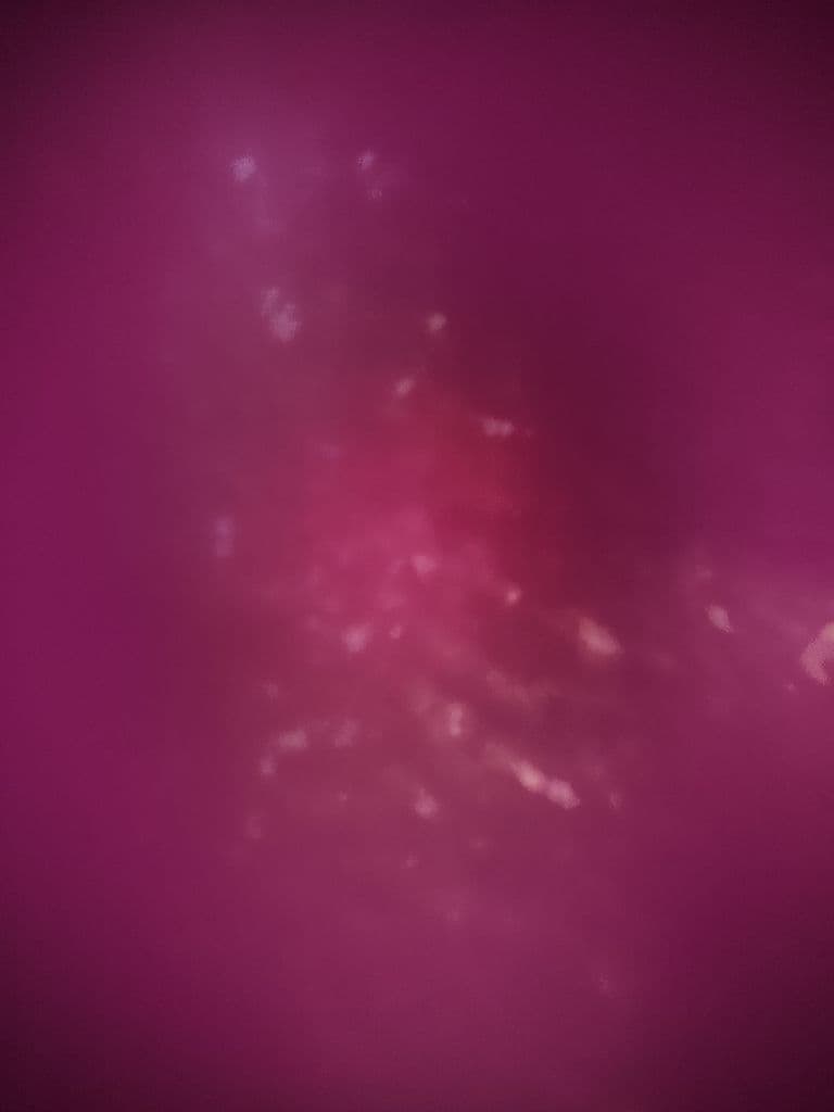 ANML media 1